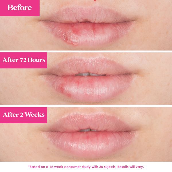 GrandePOUT Plumping Lip Mask Berry Mojito